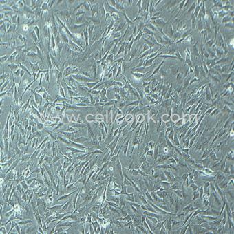 SW579人甲狀腺鱗癌細(xì)胞（STR鑒定正確）