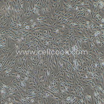 8305C人甲狀腺癌細(xì)胞（退行性）（STR鑒定正確）