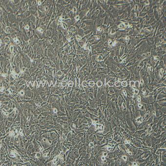 KHM-5M人甲狀腺癌細(xì)胞（退行性）（STR鑒定正確）