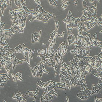 TT人甲狀腺導(dǎo)管癌細(xì)胞（髓樣癌）（STR鑒定正確）