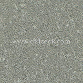 TPC-1人甲狀腺癌細胞（乳頭狀）（STR鑒定正確）