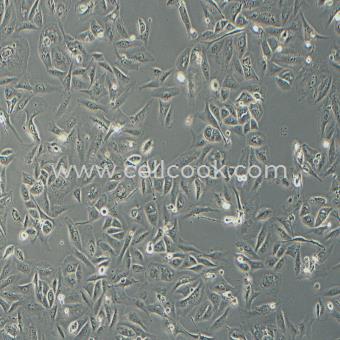 GBC-SD人膽囊癌細胞（STR鑒定正確）