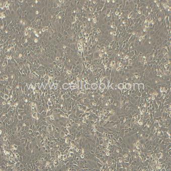 PK-59人胰腺癌細胞（STR鑒定正確）