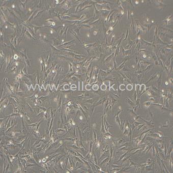 NCI-H2452人間皮瘤細胞（STR鑒定正確）