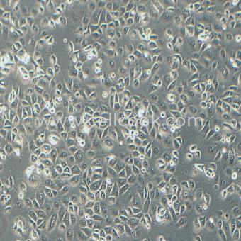 NCI-H226人間皮瘤細胞（STR鑒定正確）