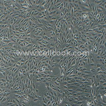 ARPE-19人視網(wǎng)膜上皮細胞（STR鑒定正確）