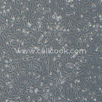 EA.hy926人臍靜脈細(xì)胞融合細(xì)胞（STR鑒定正確）