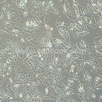 Renca小鼠腎癌細(xì)胞（STR鑒定正確）