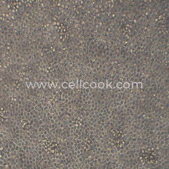 Yac-1小鼠白血病細(xì)胞NK細(xì)胞靶細(xì)胞（STR鑒定正確）