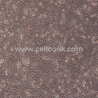 MS1小鼠胰島內(nèi)皮細胞（STR鑒定正確）