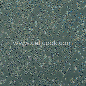 M-1小鼠腎集合管細(xì)胞（STR鑒定正確）