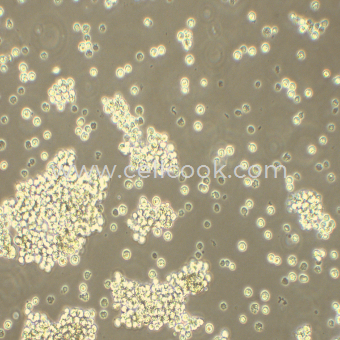 MMQ大鼠垂體瘤細胞（種屬鑒定正確）