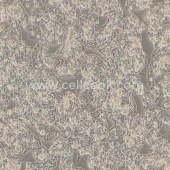 Hep G2人肝癌細(xì)胞（STR鑒定）