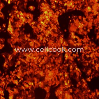 Hep G2-RFP示蹤穩(wěn)定細(xì)胞株（STR鑒定正確）