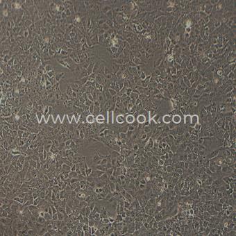 Huh-7-LUC示蹤穩(wěn)定細(xì)胞株（STR鑒定正確）