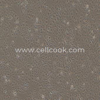 Huh-7人肝癌細(xì)胞（STR鑒定正確）