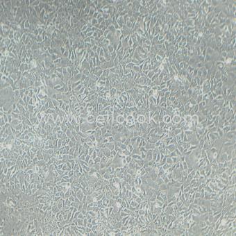 Hep3B人肝癌細(xì)胞（STR鑒定正確）