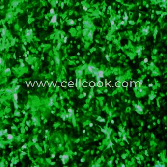 SK-HEP-1-GFP示蹤穩(wěn)定細(xì)胞株（STR鑒定正確）