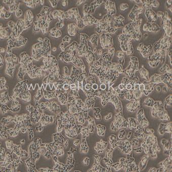 HepG2 2.2.15表達(dá)HBV病毒的人肝癌細(xì)胞（STR鑒定正確）