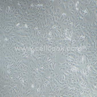 RBE人膽管細(xì)胞型肝癌細(xì)胞（STR鑒定正確）