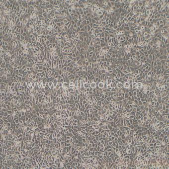 NCI-H292人肺粘液上皮樣癌細(xì)胞（STR鑒定正確）