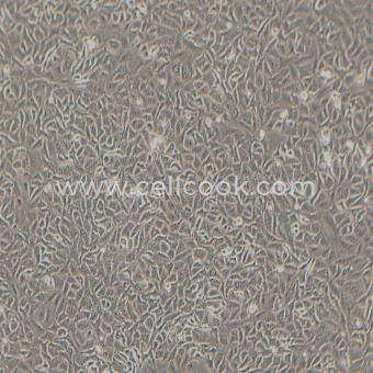 A549人非小細(xì)胞肺癌細(xì)胞（STR鑒定正確）