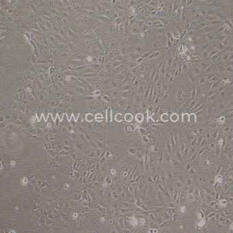 HUCC-T1人膽管上皮癌細(xì)胞（STR鑒定正確）