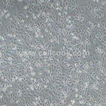 A549-LUC示蹤穩(wěn)定細(xì)胞株（STR鑒定正確）