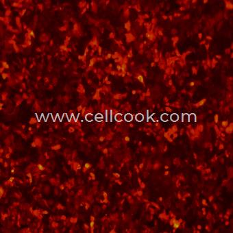 A549-RFP示蹤穩(wěn)定細(xì)胞株（STR鑒定正確）