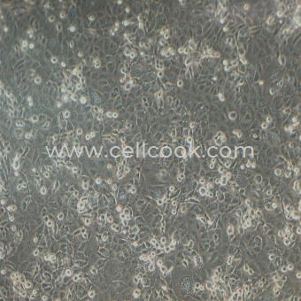 NCI-H1299人非小細(xì)胞肺癌細(xì)胞（STR鑒定正確）