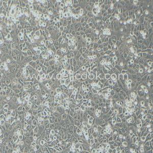 NCI-H1299-LUC示蹤穩(wěn)定細(xì)胞株（STR鑒定正確）