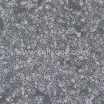 PC9人非小細(xì)胞肺癌細(xì)胞（STR鑒定正確）