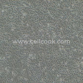 NCI-H358人非小細(xì)胞肺癌細(xì)胞（STR鑒定正確）