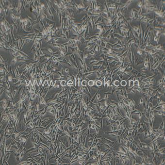 NCI-H1975人非小細(xì)胞肺腺癌細(xì)胞（STR鑒定正確）