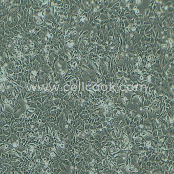 NCI-H1975-LUC示蹤穩(wěn)定細(xì)胞株（STR鑒定正確）