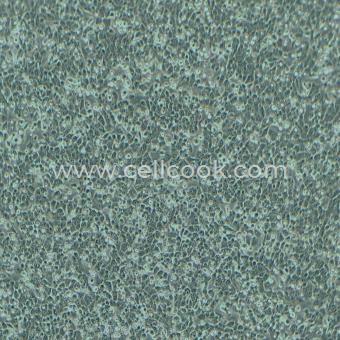 NCI-H460人大細(xì)胞肺癌細(xì)胞（STR鑒定正確）