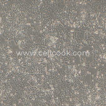 NCI-H520人肺鱗癌細(xì)胞（STR鑒定正確）