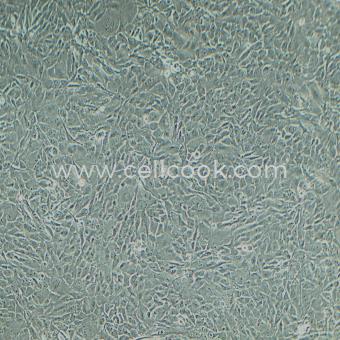 Calu-1人肺癌細(xì)胞（STR鑒定正確）