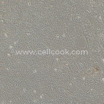 HCC827人非小細(xì)胞肺癌細(xì)胞（STR鑒定正確）