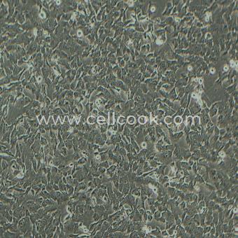 SK-MES-1人肺鱗癌細(xì)胞（STR鑒定正確）