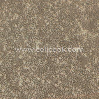 NCI-H23人非小細(xì)胞肺癌細(xì)胞（STR鑒定正確）