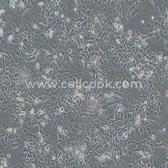 HCC4006人肺癌腺癌細(xì)胞（STR鑒定正確）