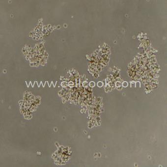 NCI-H524人小細(xì)胞肺癌細(xì)胞（STR鑒定正確）