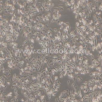 Calu-6人退行性肺癌細(xì)胞（STR鑒定正確）