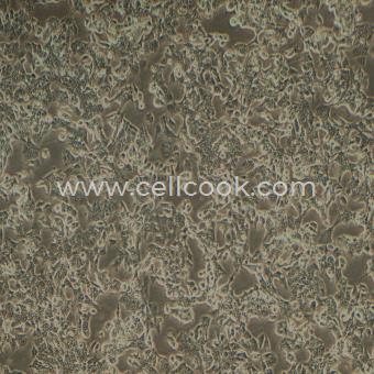 NCI-H2087人非小細(xì)胞肺腺癌細(xì)胞（STR鑒定正確）