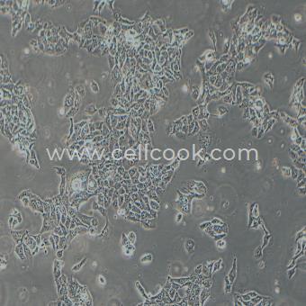 NCI-H441人肺腺癌細(xì)胞（STR鑒定正確）