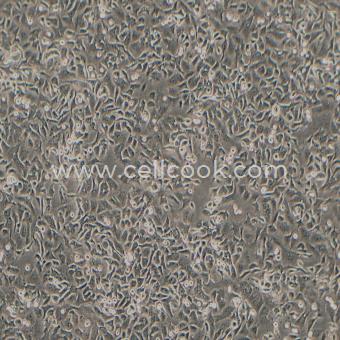 NCI-H2122人肺腺癌細(xì)胞（STR鑒定正確）