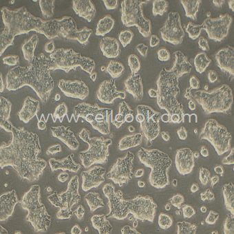 NCI-H1688人小細(xì)胞肺癌細(xì)胞（STR鑒定正確）