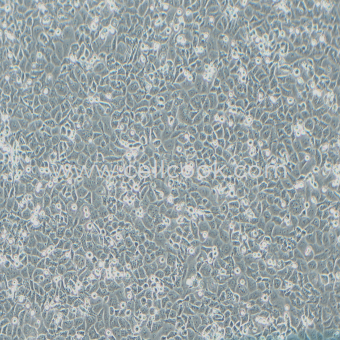 NCI-H522人肺腺癌細(xì)胞（STR鑒定正確）