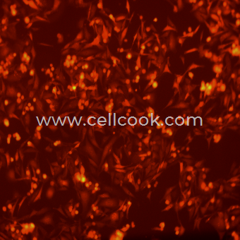 MDA-MB-231-RFP示蹤穩(wěn)定細(xì)胞株（STR鑒定正確）